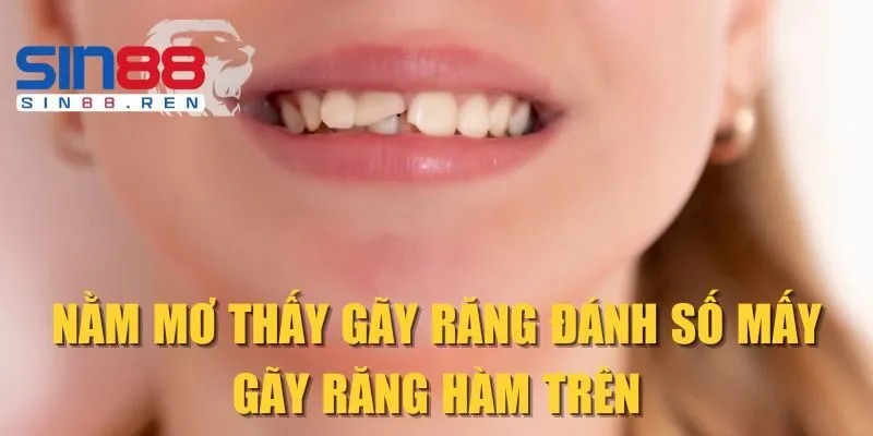 Nằm mơ thấy gãy răng đánh số mấy - Gãy răng hàm trên